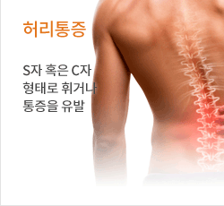 허리통증 S자 혹은 C자형태로 휘거나 통증을 유발하는 증상