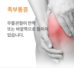 족부통증 무릎관절이 안쪽 또는 바깥쪽으로 틀어져 있습니다.