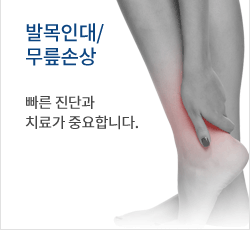 발목인대/무릎손상 휘어진 다리에서 시작되는 통증
