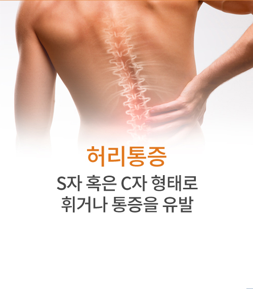 허리통증 S자 혹은 C자형태로 휘거나 통증을 유발하는 증상