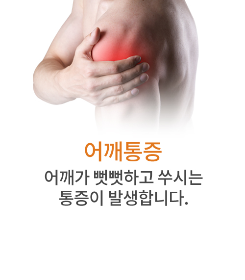 어깨통증 어깨가 뻣뻣하고 쑤시는 통증이 발생합니다.