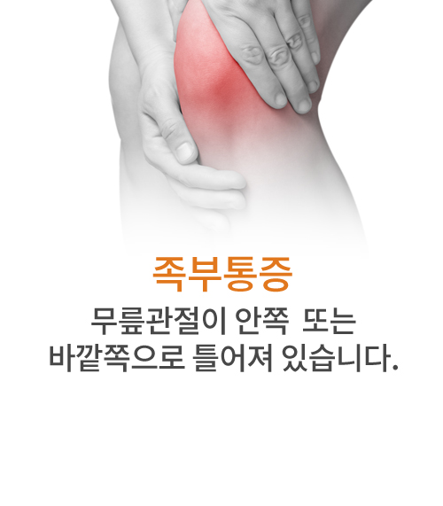 족부통증 무릎관절이 안쪽 또는 바깥쪽으로 틀어져 있습니다.
